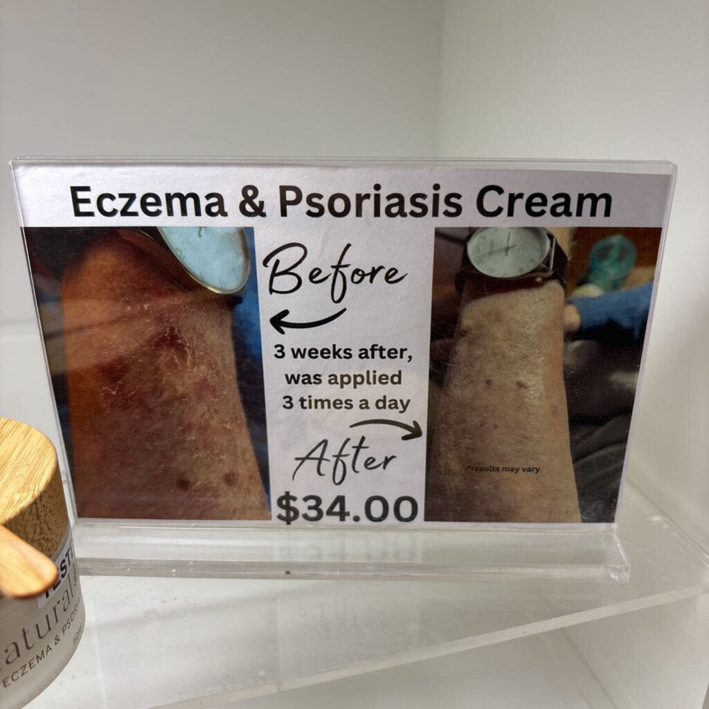 ECZEMA&PSORIASIS CREAM